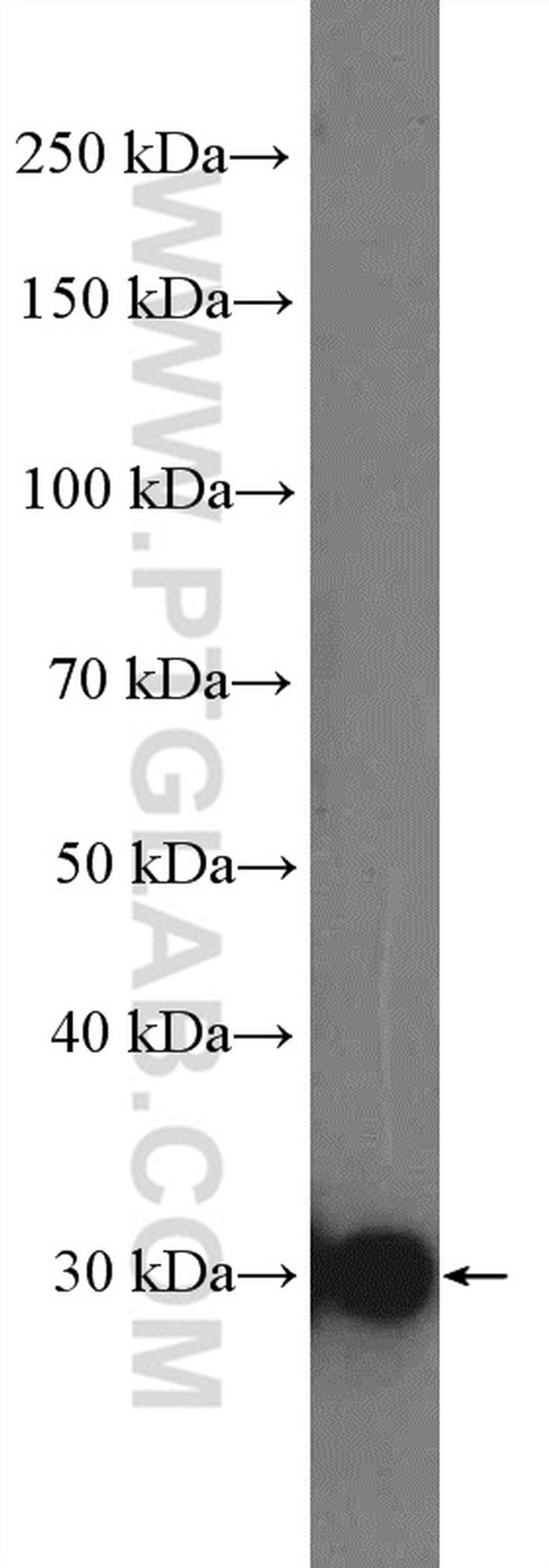 SULT4A1 Antibody in Western Blot (WB)