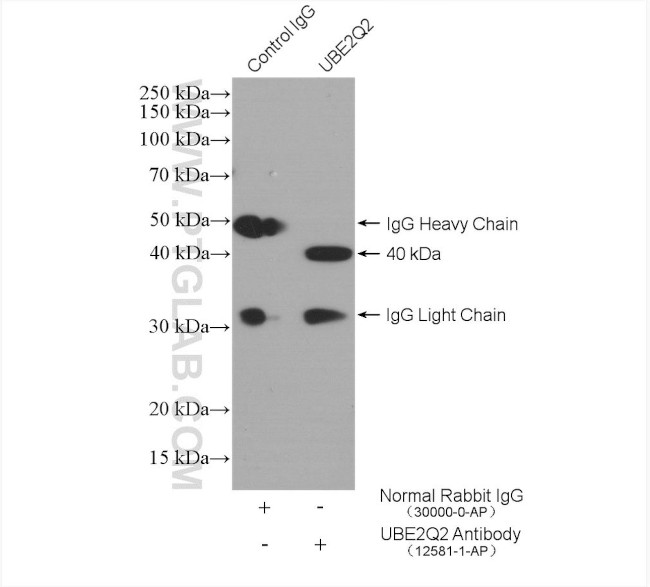 UBE2Q2 Antibody in Immunoprecipitation (IP)