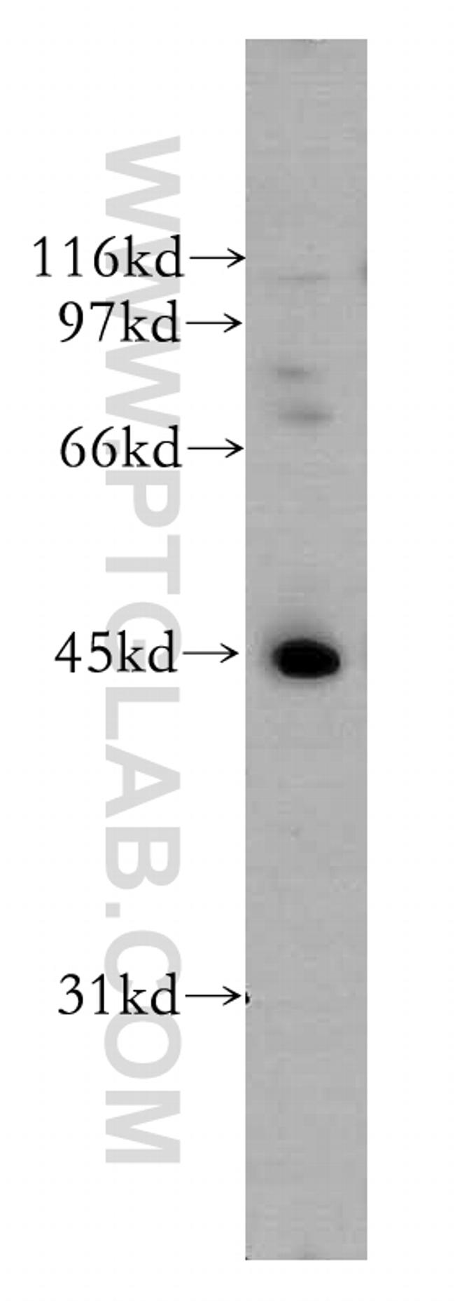 UBE2Q2 Antibody in Western Blot (WB)