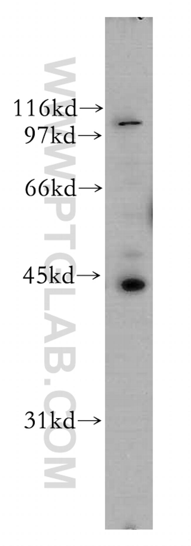 UBE2Q2 Antibody in Western Blot (WB)