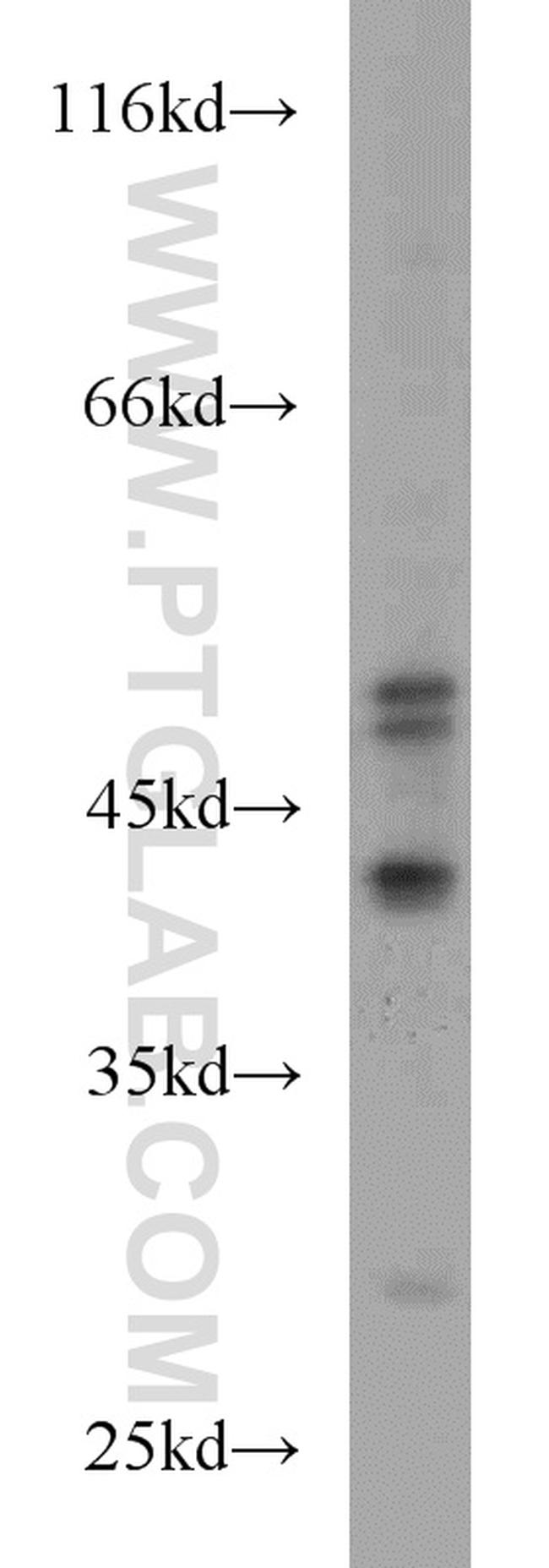 GABPB1 Antibody in Western Blot (WB)