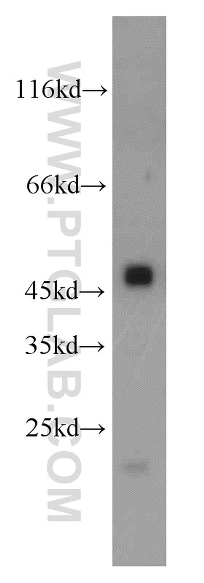 CPB1 Antibody in Western Blot (WB)