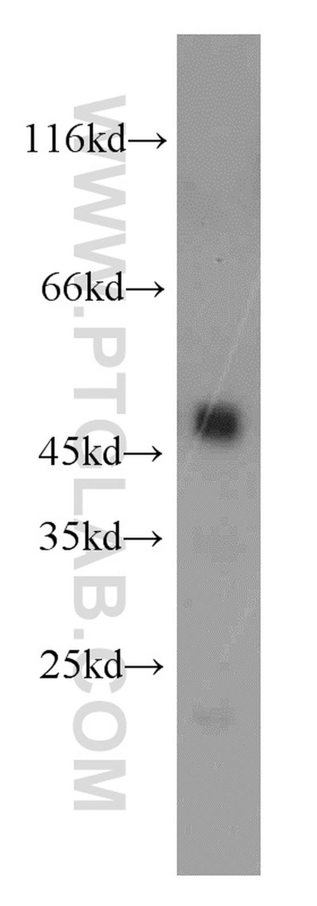CPB1 Antibody in Western Blot (WB)