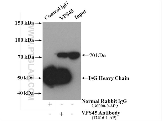 VPS45 Antibody in Immunoprecipitation (IP)