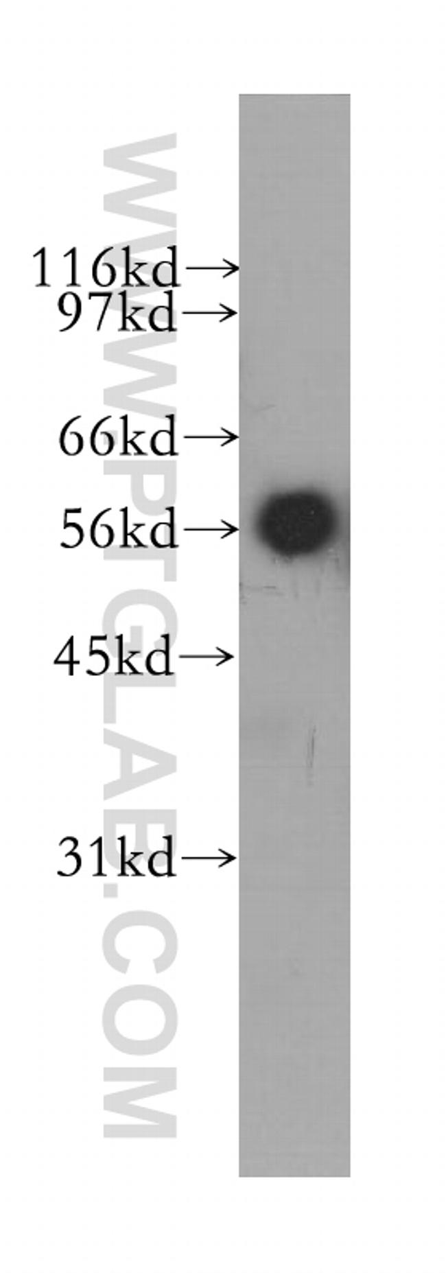 CYB5R4 Antibody in Western Blot (WB)