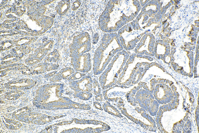 SUCLA2 Antibody in Immunohistochemistry (Paraffin) (IHC (P))