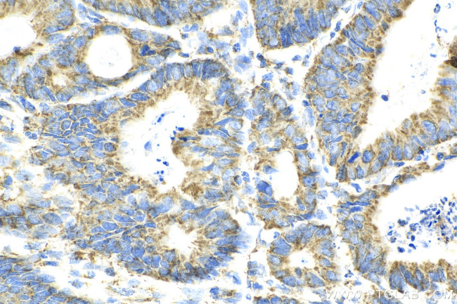 SUCLA2 Antibody in Immunohistochemistry (Paraffin) (IHC (P))