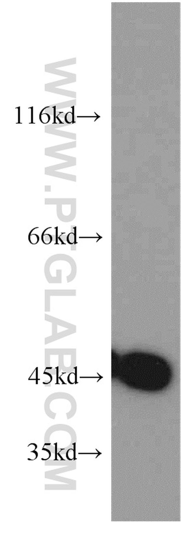 SUCLA2 Antibody in Western Blot (WB)