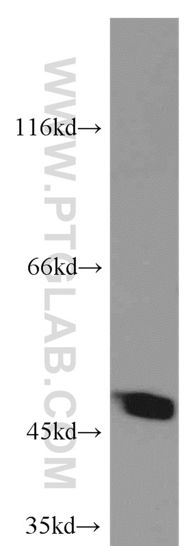 SUCLA2 Antibody in Western Blot (WB)