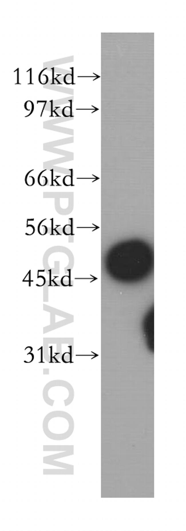 SUCLA2 Antibody in Western Blot (WB)