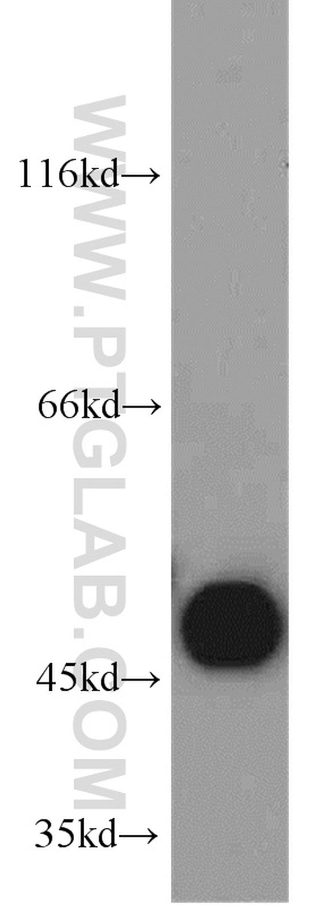 SUCLA2 Antibody in Western Blot (WB)