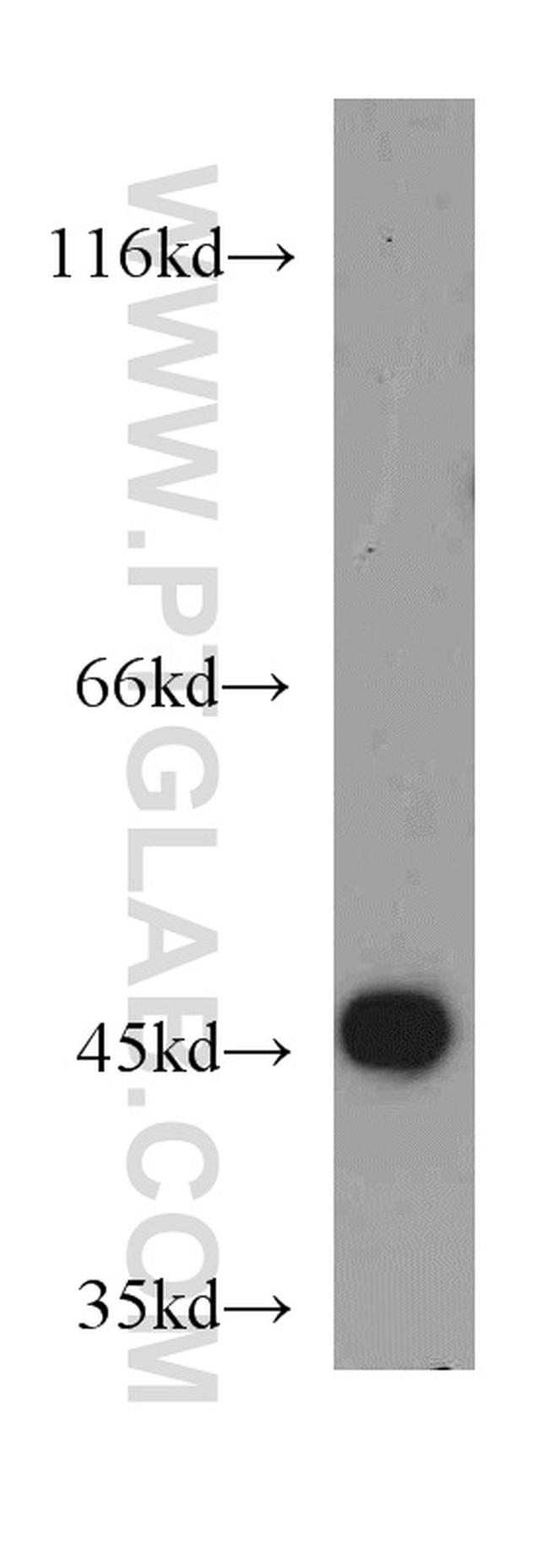 SUCLA2 Antibody in Western Blot (WB)