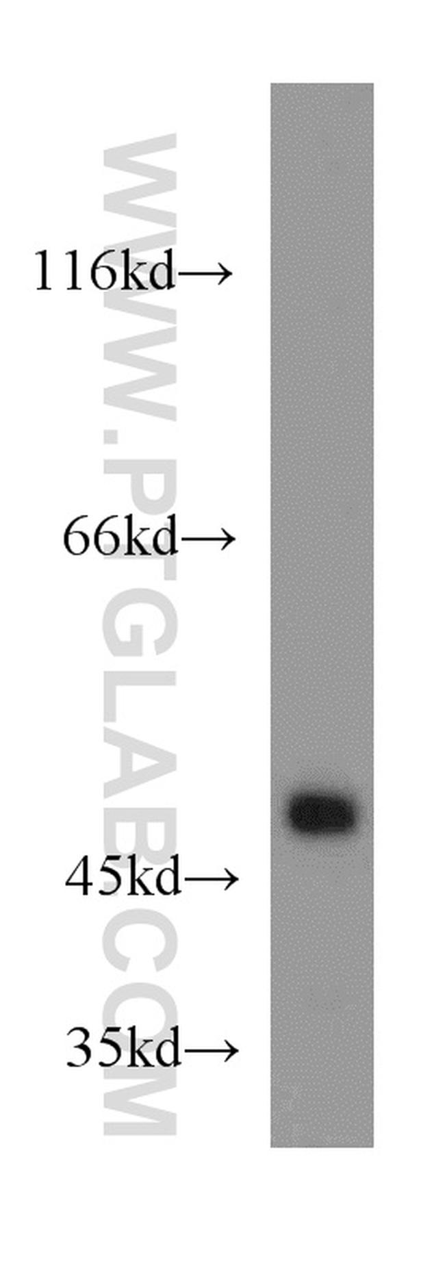 SUCLA2 Antibody in Western Blot (WB)