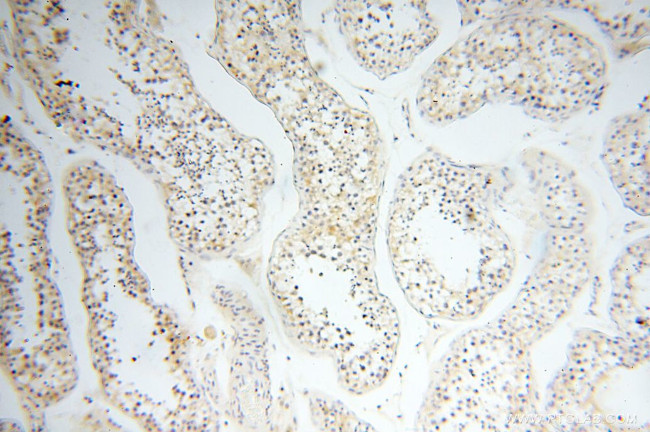 LAMP3 Antibody in Immunohistochemistry (Paraffin) (IHC (P))