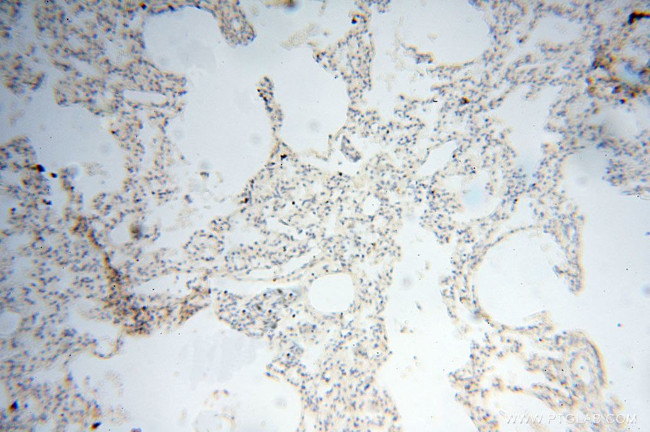 LAMP3 Antibody in Immunohistochemistry (Paraffin) (IHC (P))