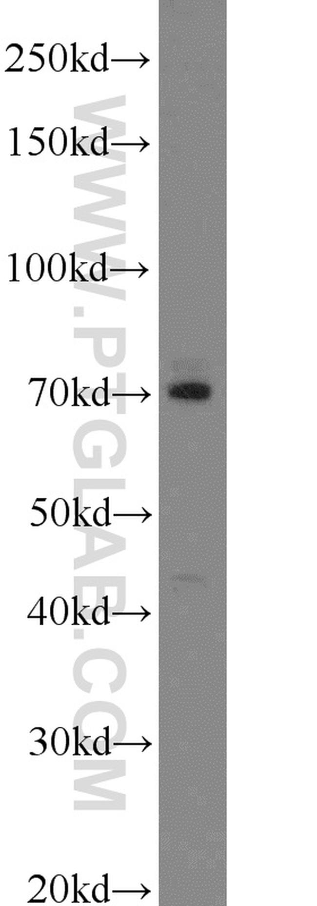 LAMP3 Antibody in Western Blot (WB)