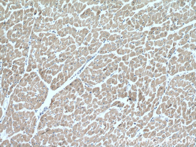 CIAPIN1 Antibody in Immunohistochemistry (Paraffin) (IHC (P))