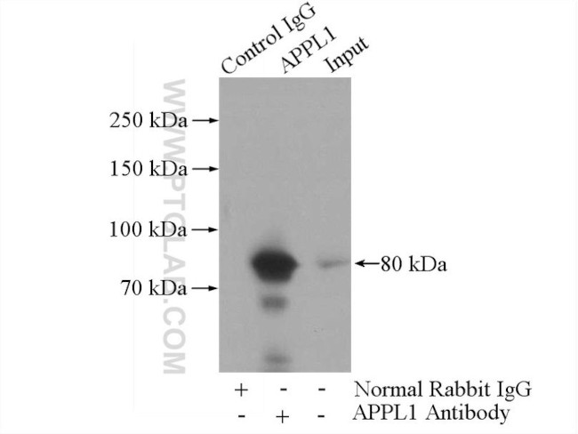 APPL1 Antibody in Immunoprecipitation (IP)