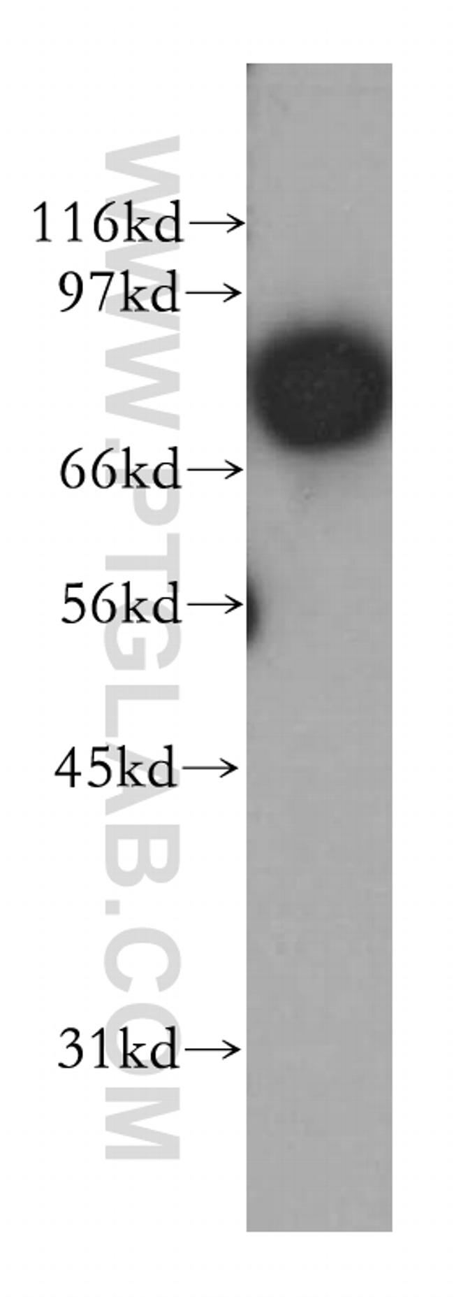 APPL1 Antibody in Western Blot (WB)