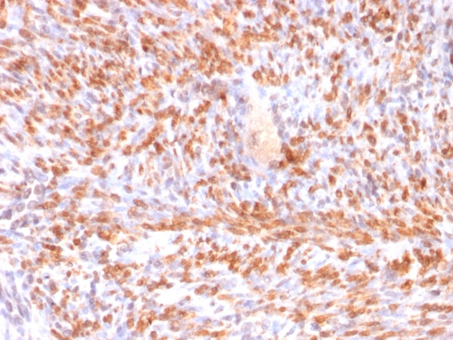 Calponin-1 Antibody in Immunohistochemistry (Paraffin) (IHC (P))