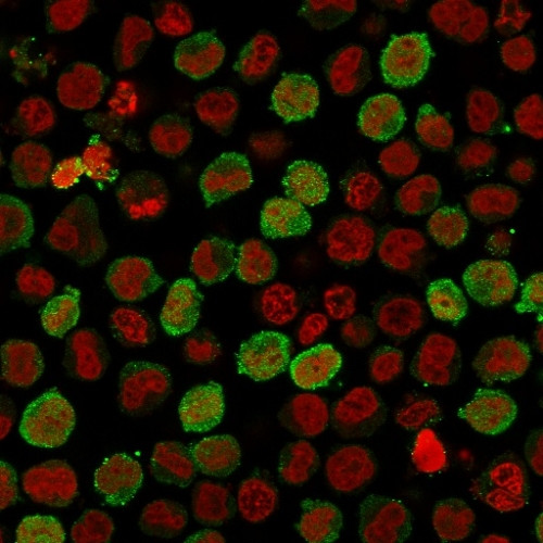 Calponin-1 Antibody in Immunocytochemistry (ICC/IF)