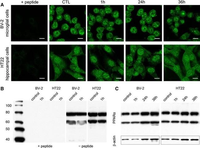 PPAR alpha Antibody in Immunocytochemistry (ICC/IF)