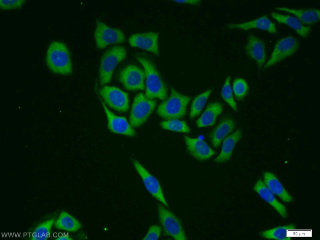 GlnRS Antibody in Immunocytochemistry (ICC/IF)