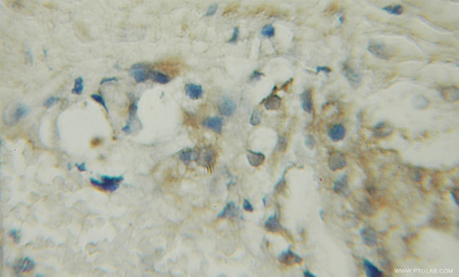 GlnRS Antibody in Immunohistochemistry (Paraffin) (IHC (P))