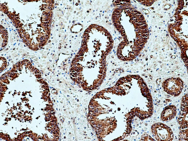 GlnRS Antibody in Immunohistochemistry (Paraffin) (IHC (P))