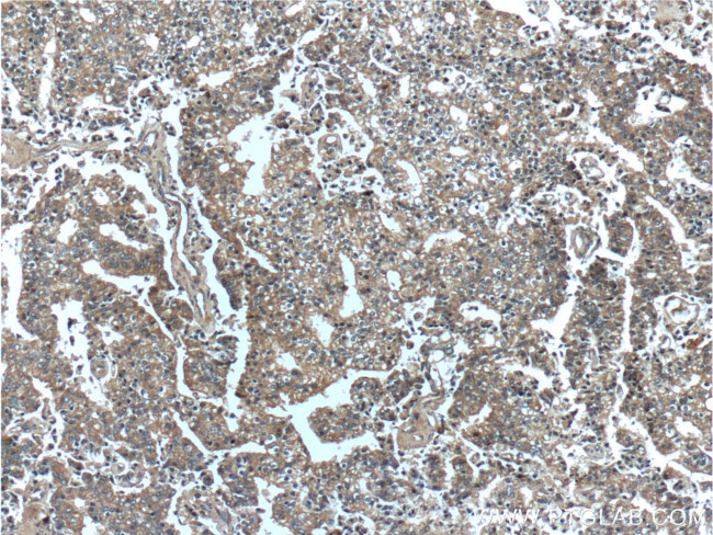 PDE9A Antibody in Immunohistochemistry (Paraffin) (IHC (P))