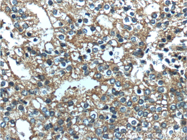 PDE9A Antibody in Immunohistochemistry (Paraffin) (IHC (P))