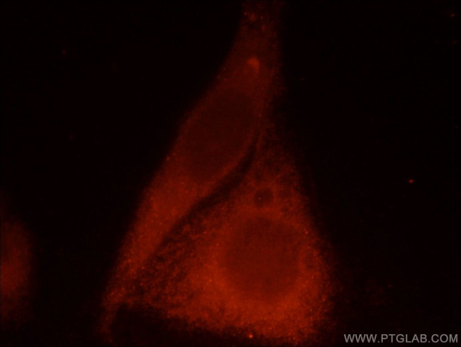 CaMKII gamma Antibody in Immunocytochemistry (ICC/IF)