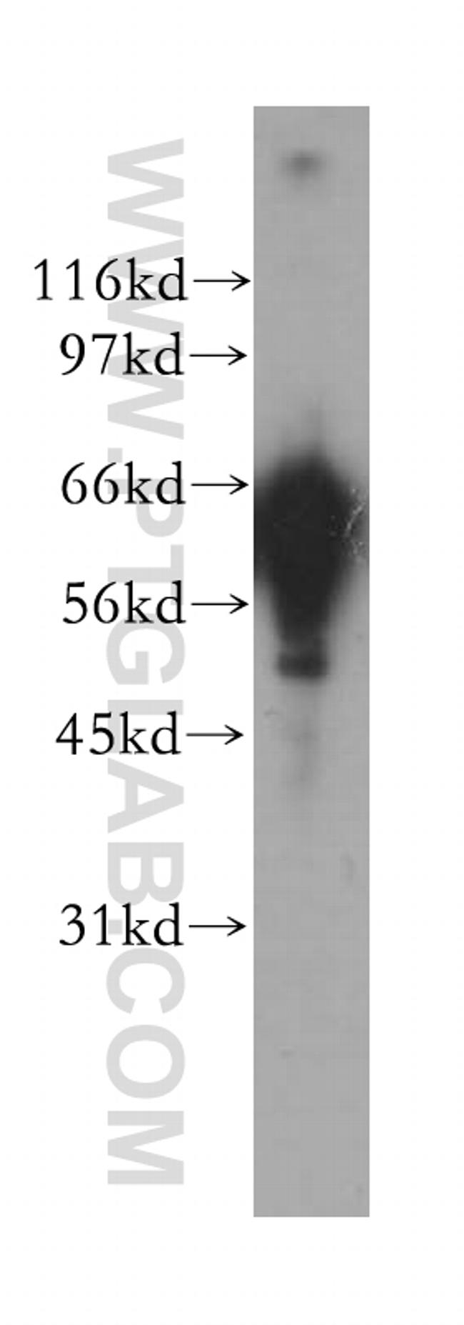 CaMKII gamma Antibody in Western Blot (WB)