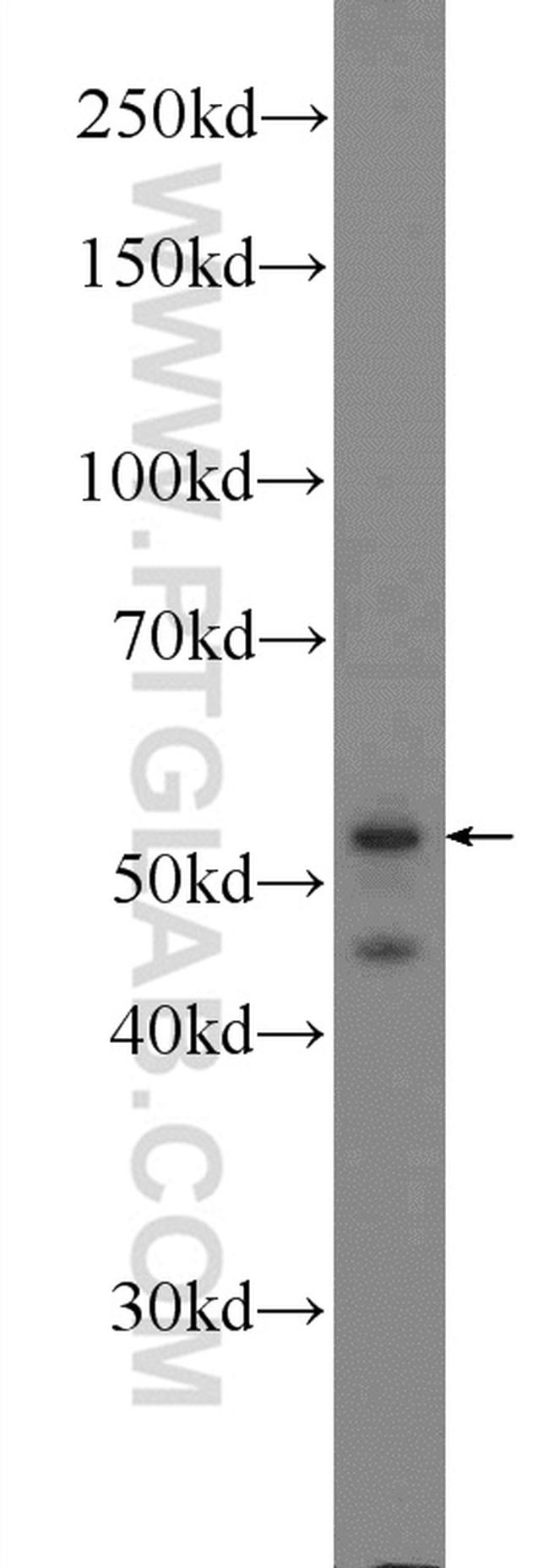 CaMKII gamma Antibody in Western Blot (WB)