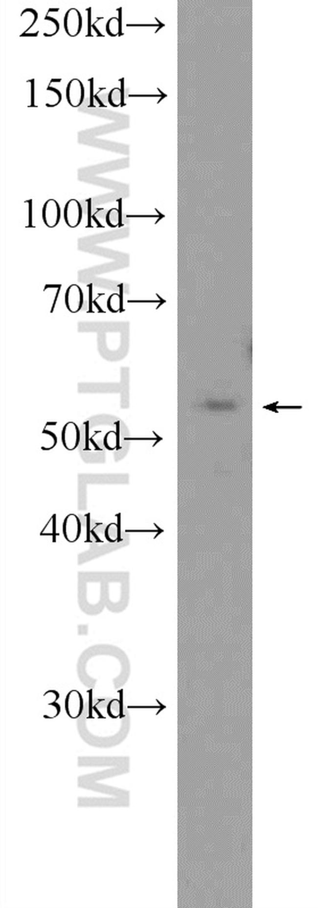 CaMKII gamma Antibody in Western Blot (WB)