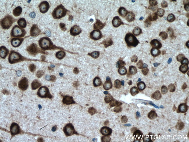 CPEB3 Antibody in Immunohistochemistry (Paraffin) (IHC (P))