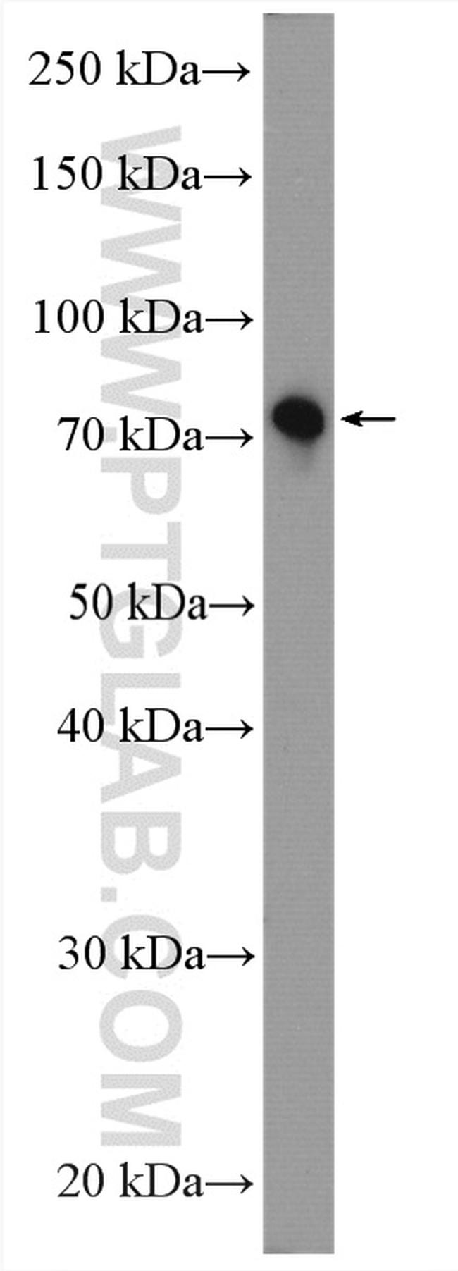 SHCBP1 Antibody in Western Blot (WB)