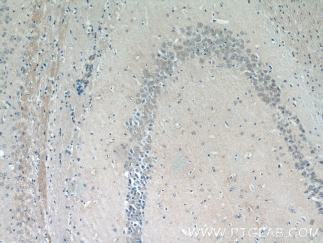 ZNF238 Antibody in Immunohistochemistry (Paraffin) (IHC (P))