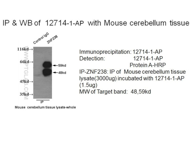 ZNF238 Antibody in Immunoprecipitation (IP)