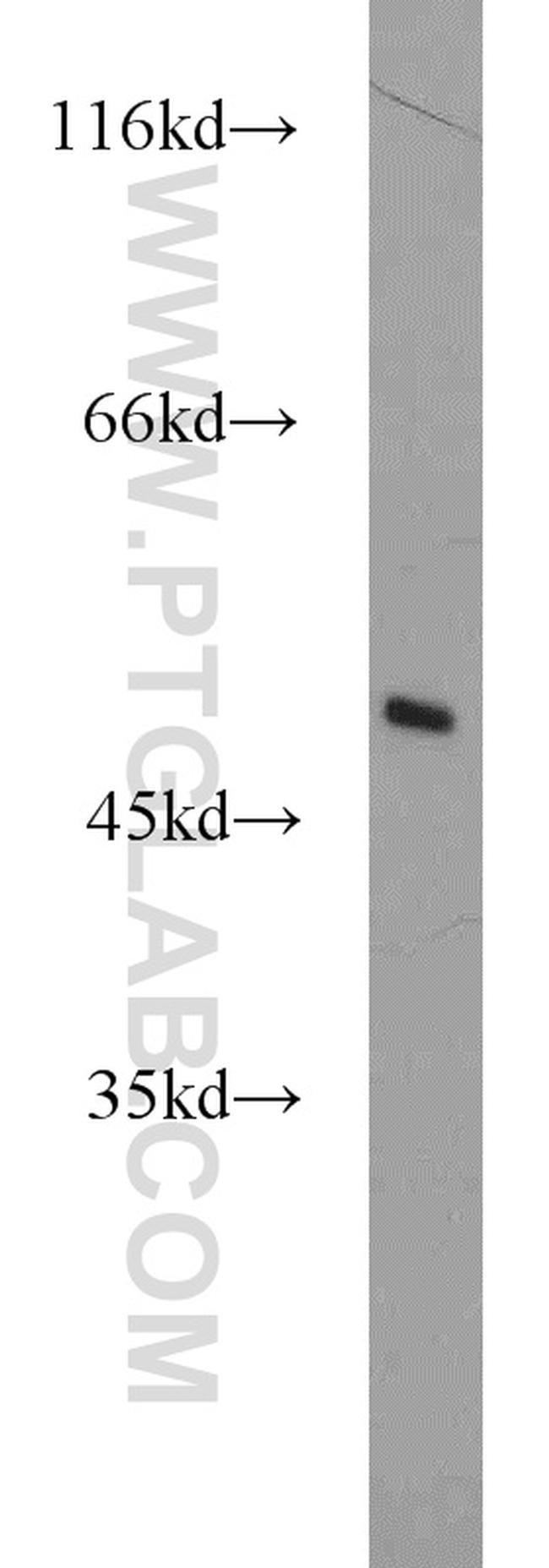 ZNF238 Antibody in Western Blot (WB)