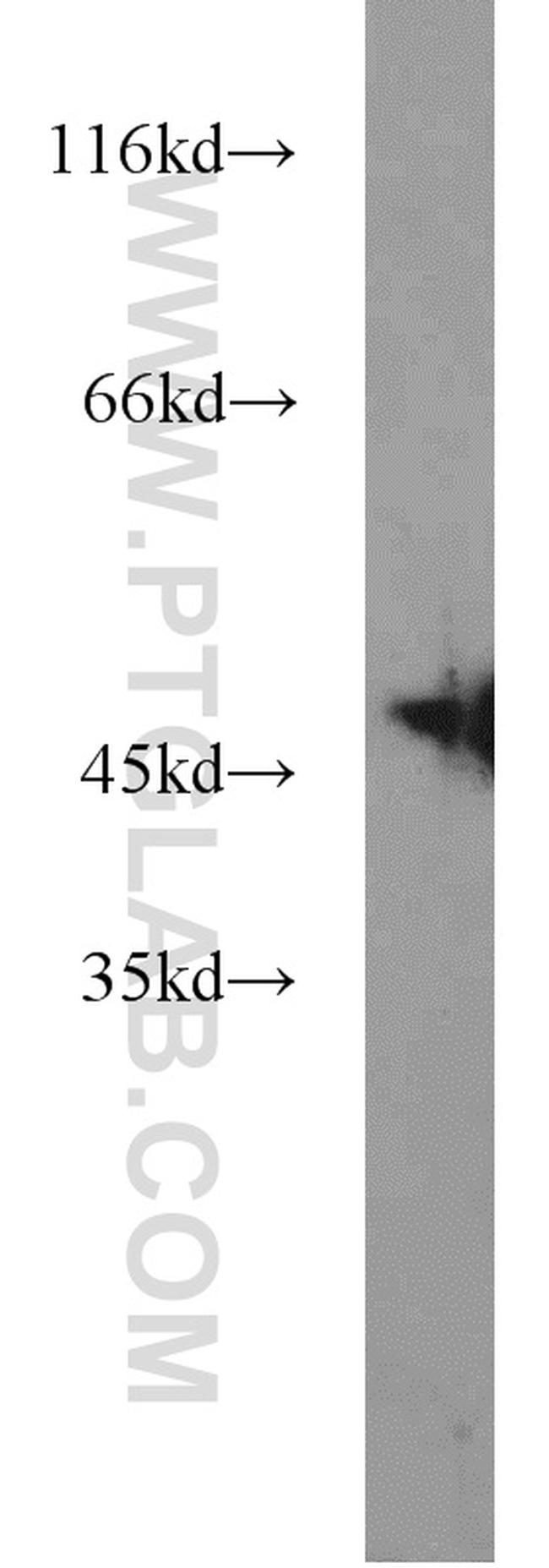 ZNF238 Antibody in Western Blot (WB)