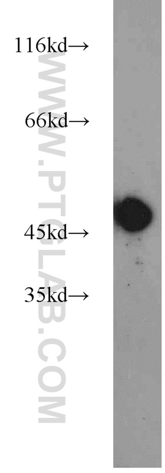 ZNF238 Antibody in Western Blot (WB)