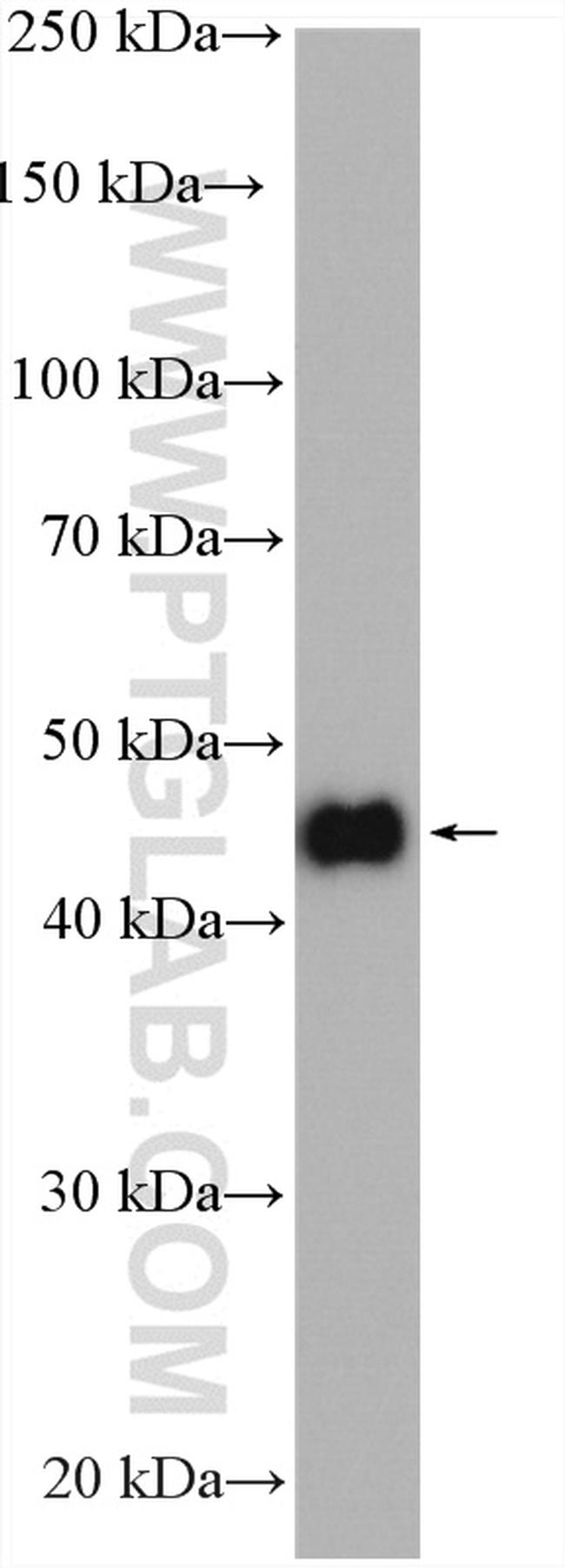 ZNF238 Antibody in Western Blot (WB)