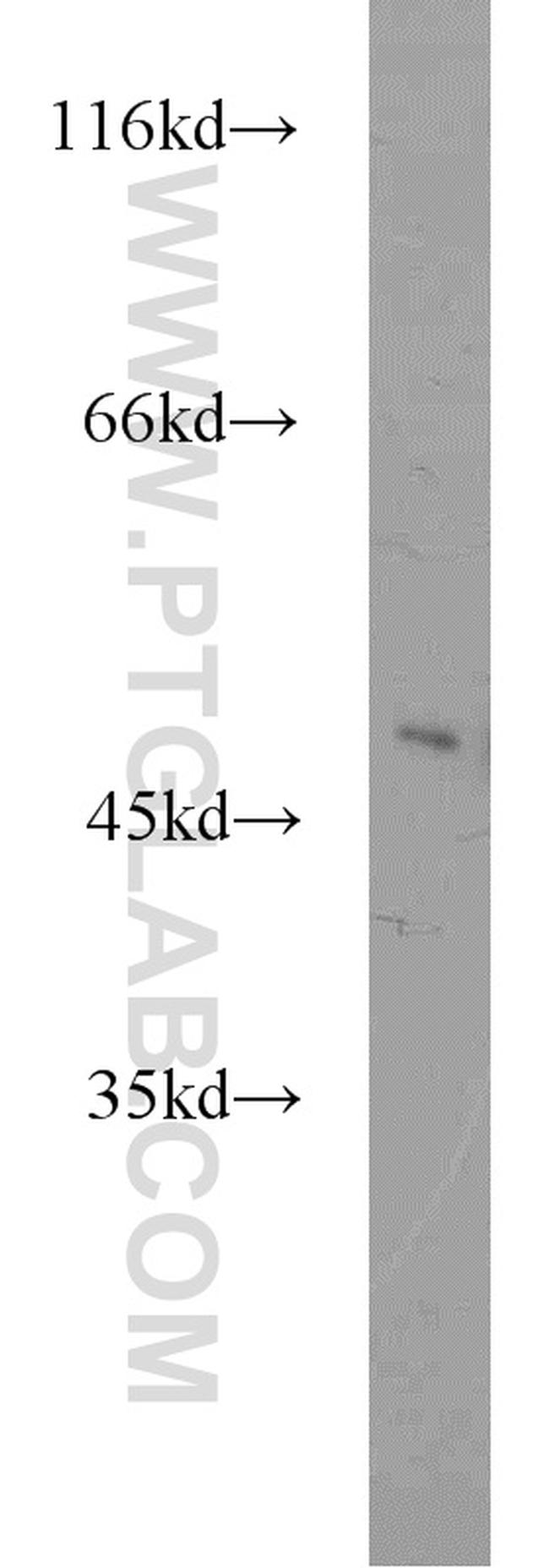 ZNF238 Antibody in Western Blot (WB)