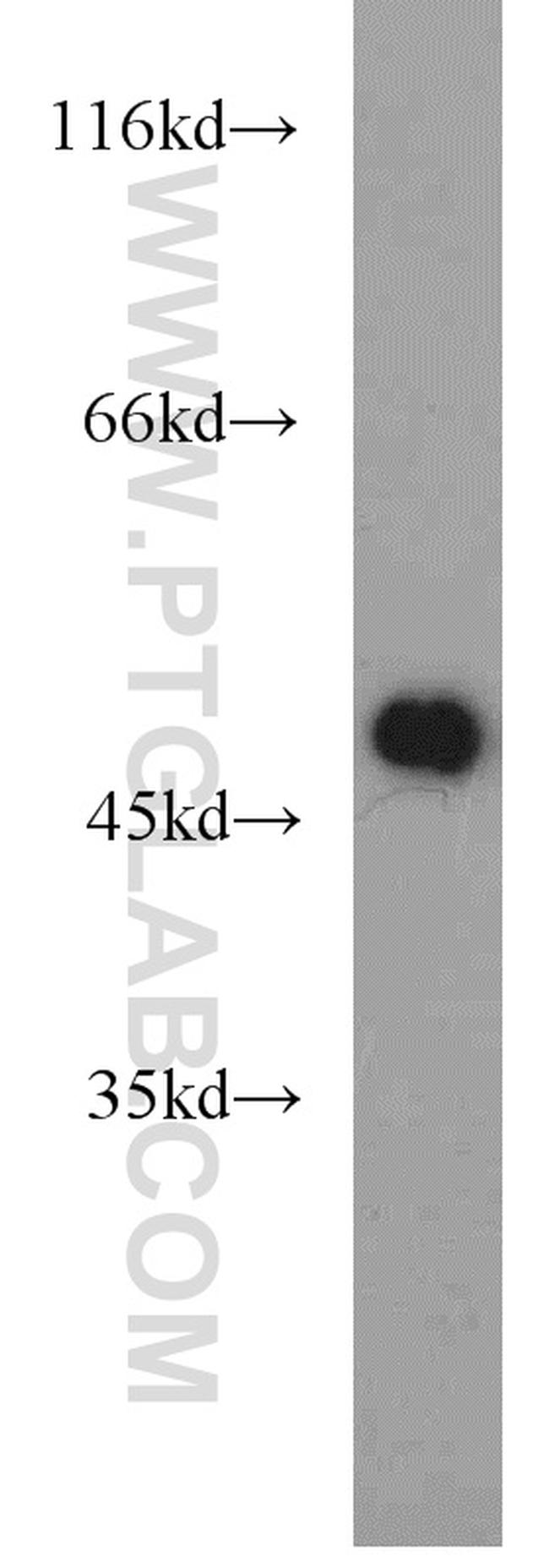 ZNF238 Antibody in Western Blot (WB)