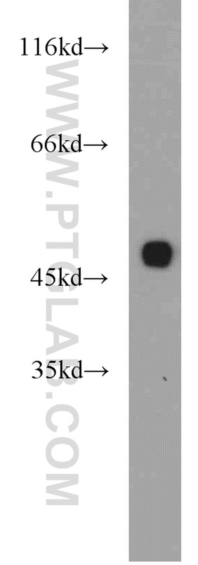 ZNF238 Antibody in Western Blot (WB)