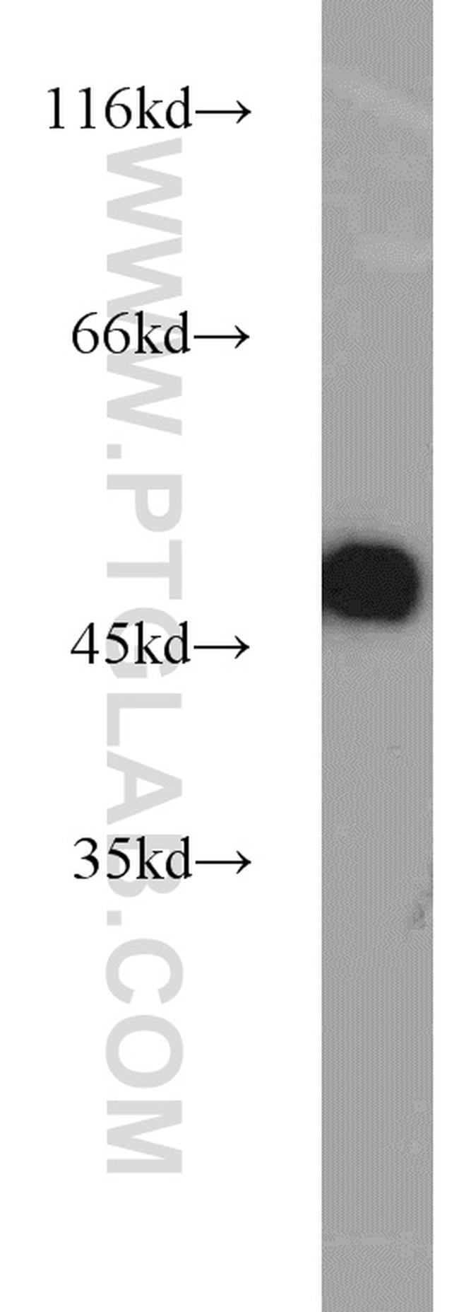 ZNF238 Antibody in Western Blot (WB)