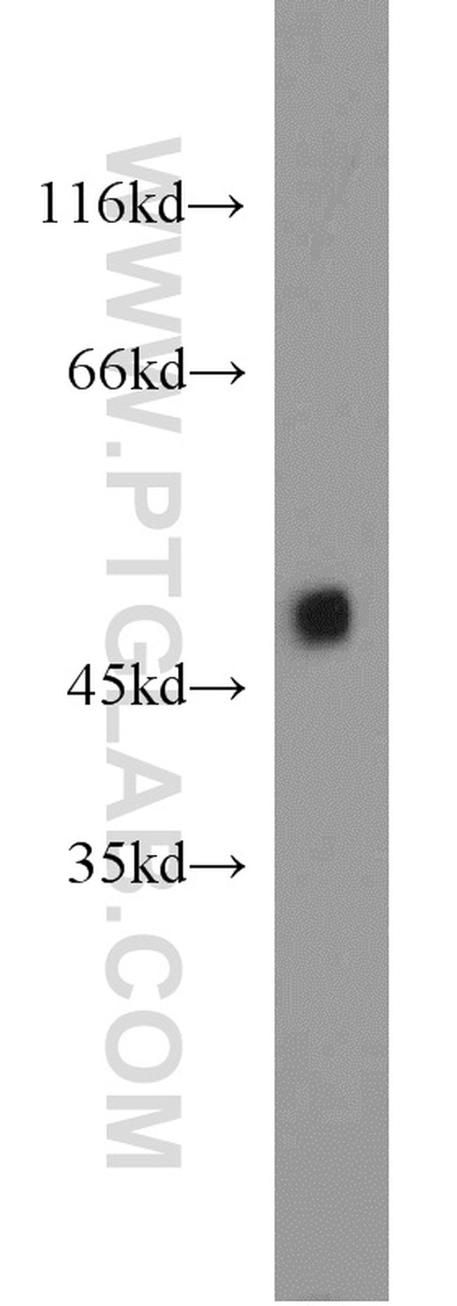 ZNF238 Antibody in Western Blot (WB)