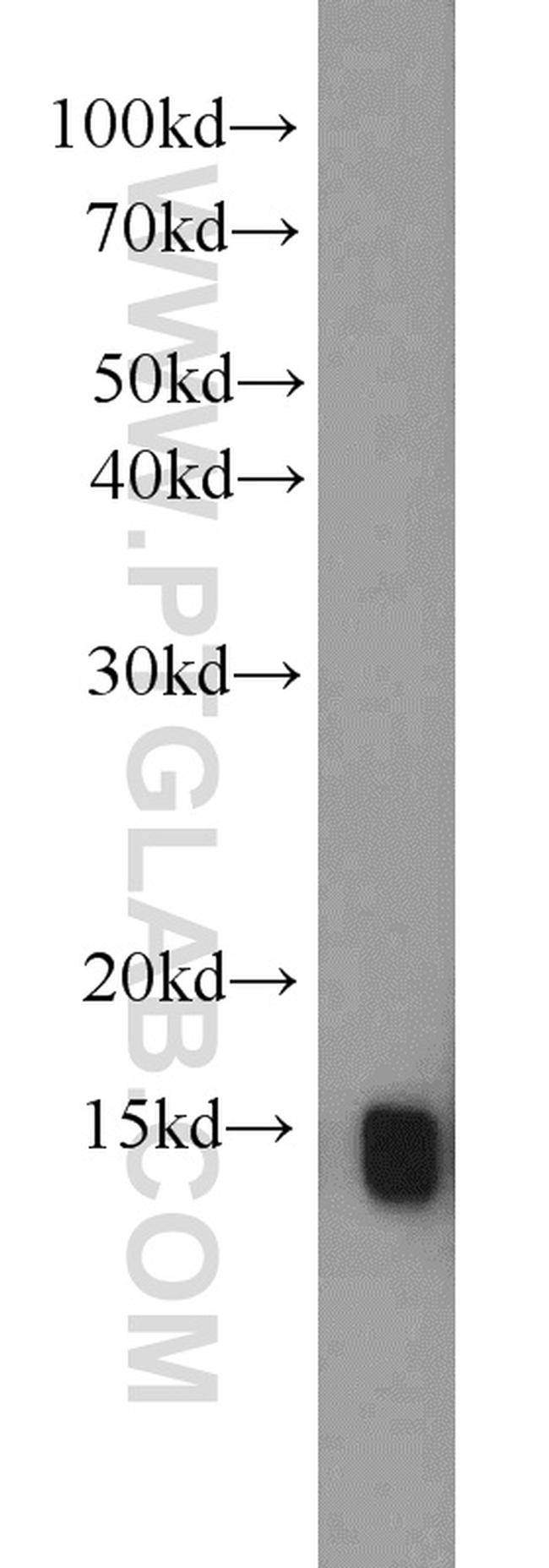 PMP2 Antibody in Western Blot (WB)