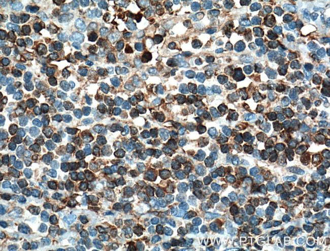 SLP76 Antibody in Immunohistochemistry (Paraffin) (IHC (P))